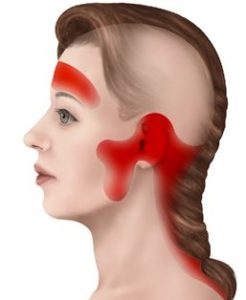 Different types of headaches werribee